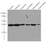 TMOD2 Antibody in Western Blot (WB)