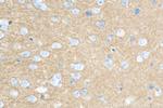 Synaptotagmin-1 Antibody in Immunohistochemistry (Paraffin) (IHC (P))