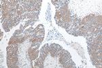 TTLL12 Antibody in Immunohistochemistry (Paraffin) (IHC (P))