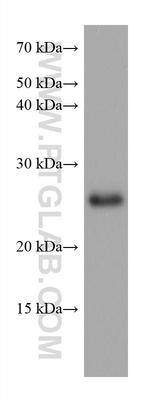 TPPP Antibody in Western Blot (WB)