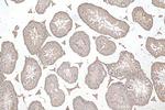 GAS2L1 Antibody in Immunohistochemistry (Paraffin) (IHC (P))