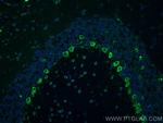 RPL9 Antibody in Immunohistochemistry (Paraffin) (IHC (P))