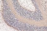 RPL9 Antibody in Immunohistochemistry (Paraffin) (IHC (P))