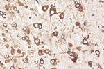 RPL9 Antibody in Immunohistochemistry (Paraffin) (IHC (P))