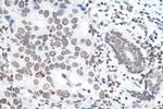 m6A Antibody in Immunohistochemistry (Paraffin) (IHC (P))