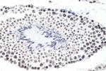 m6A Antibody in Immunohistochemistry (Paraffin) (IHC (P))