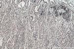m6A Antibody in Immunohistochemistry (Paraffin) (IHC (P))