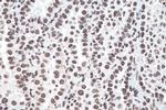 m6A Antibody in Immunohistochemistry (Paraffin) (IHC (P))