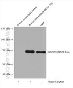 m6A Antibody in Immunoprecipitation (IP)
