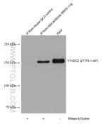 m6A Antibody in Immunoprecipitation (IP)