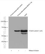 m6A Antibody in Immunoprecipitation (IP)