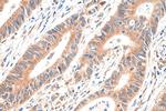 RPLP0 Antibody in Immunohistochemistry (Paraffin) (IHC (P))