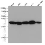 RPLP0 Antibody in Western Blot (WB)
