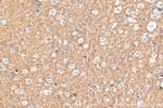 FXYD6 Antibody in Immunohistochemistry (Paraffin) (IHC (P))