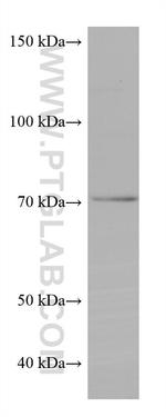 NSF Antibody in Western Blot (WB)