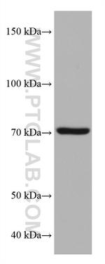 NSF Antibody in Western Blot (WB)