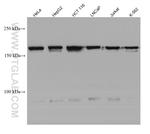 TBC1D4 Antibody in Western Blot (WB)