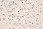 FTL Antibody in Immunohistochemistry (Paraffin) (IHC (P))