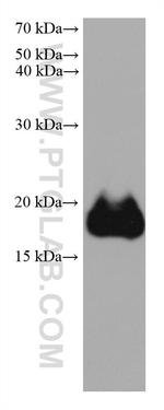 FTL Antibody in Western Blot (WB)