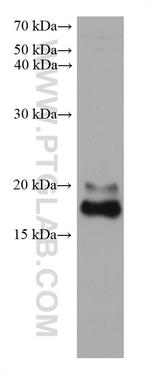 FTL Antibody in Western Blot (WB)