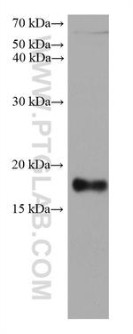 FTL Antibody in Western Blot (WB)