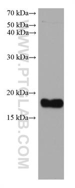 FTL Antibody in Western Blot (WB)