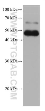 STRA8 Antibody in Western Blot (WB)