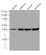 Septin 5 Antibody in Western Blot (WB)