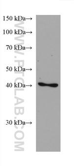 Septin 5 Antibody in Western Blot (WB)