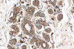 TPD52L2 Antibody in Immunohistochemistry (Paraffin) (IHC (P))
