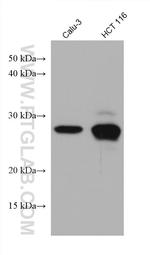 TPD52L2 Antibody in Western Blot (WB)