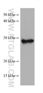 TPD52L2 Antibody in Western Blot (WB)