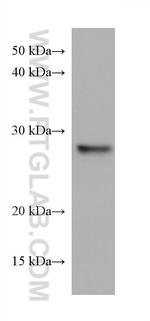 TPD52L2 Antibody in Western Blot (WB)