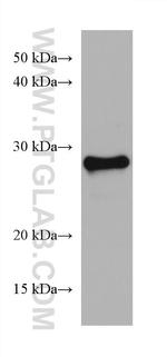 TPD52L2 Antibody in Western Blot (WB)