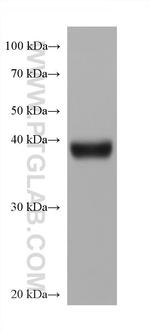 DPEP1 Antibody in Western Blot (WB)