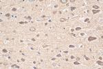 GDAP1 Antibody in Immunohistochemistry (Paraffin) (IHC (P))
