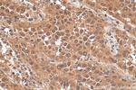 Annexin A11 Antibody in Immunohistochemistry (Paraffin) (IHC (P))