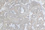 FBXW11 Antibody in Immunohistochemistry (Paraffin) (IHC (P))