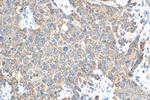 FBXW11 Antibody in Immunohistochemistry (Paraffin) (IHC (P))