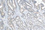 FBXW11 Antibody in Immunohistochemistry (Paraffin) (IHC (P))