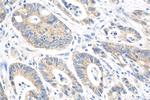 FBXW11 Antibody in Immunohistochemistry (Paraffin) (IHC (P))