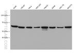 FBXW11 Antibody in Western Blot (WB)
