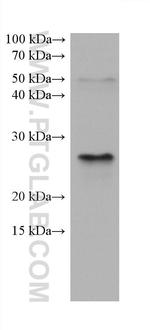 BNIP3 Antibody in Western Blot (WB)