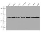 AXIN1 Antibody in Western Blot (WB)