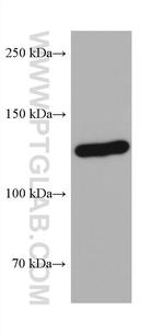 AXIN1 Antibody in Western Blot (WB)