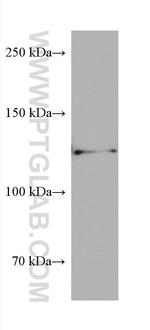 AXIN1 Antibody in Western Blot (WB)