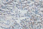 Syntenin-1 Antibody in Immunohistochemistry (Paraffin) (IHC (P))