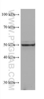 PRAME Antibody in Western Blot (WB)