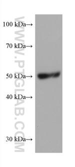 PRAME Antibody in Western Blot (WB)