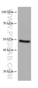 PRAME Antibody in Western Blot (WB)